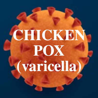 Image of Chicken Pox