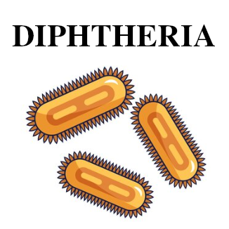Image of Diphtheria